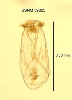 Image of Asplanchna priodonta
